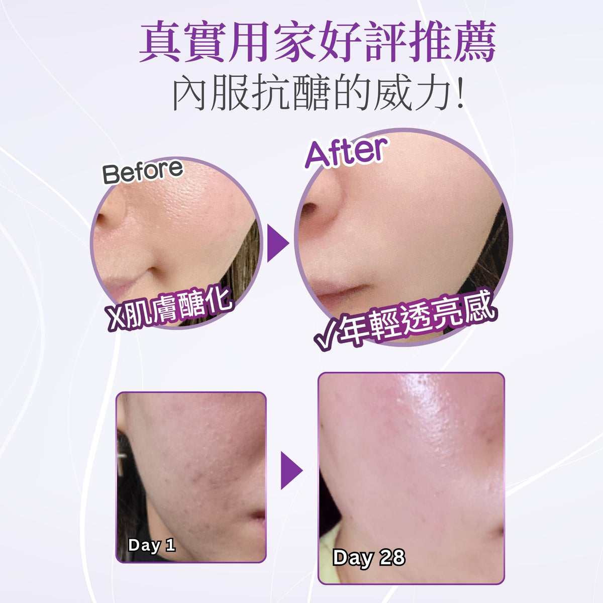 QOLLABS 山竹抗醣美肌丸 90粒（1個月份量）【多買多平】